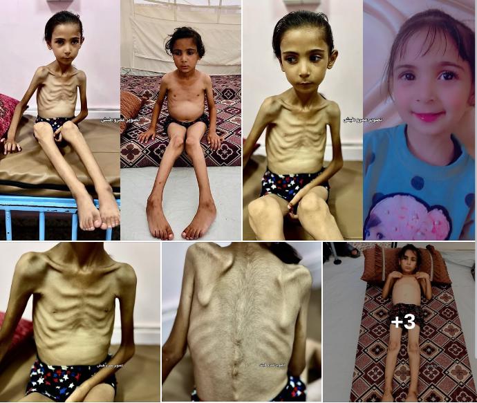 Salwa-Before-And-After